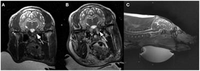 Focused Ultrasound Ablation of an Arteriovenous Malformation Model